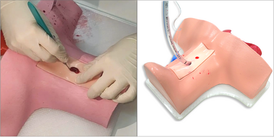 Treinamento de Cricotireoidostomia