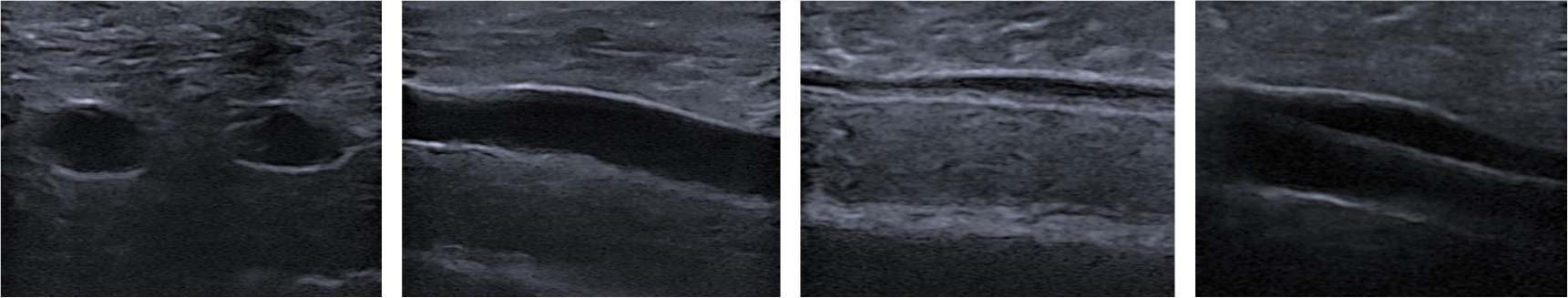 Ultrassom Simulador Pro Phantom Jugular